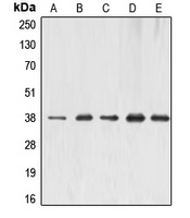 ERCC1 Rabbit Polyclonal Antibody