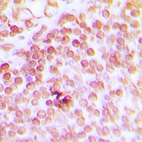 ERCC1 Rabbit Polyclonal Antibody