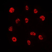 PE2 Rabbit Polyclonal Antibody