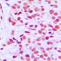 ETS1 (Phospho-T38) Antibody