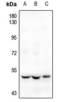 ETV1 Rabbit Polyclonal Antibody