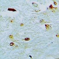 ETV1 Rabbit Polyclonal Antibody