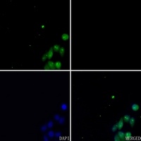 ETV1 Rabbit Polyclonal Antibody