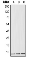 FABP1 Rabbit Polyclonal Antibody