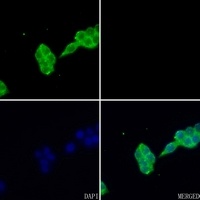 FABP1 Rabbit Polyclonal Antibody