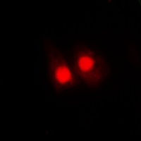 FANCA (Phospho-S1149) Antibody