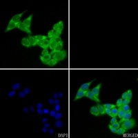 FHL2 Rabbit Polyclonal Antibody
