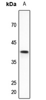 VEGFD Antibody