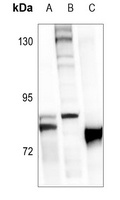 FOXO1 (Phospho-S319) Antibody