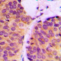 MART-1 Rabbit Polyclonal Antibody