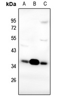 FR alpha Rabbit Polyclonal Antibody