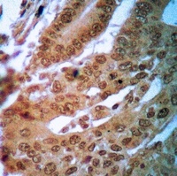 FR alpha Rabbit Polyclonal Antibody