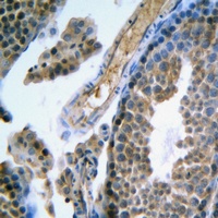 FSHR Antibody