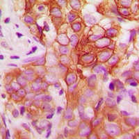 FYN (Phospho-Y530) Antibody