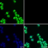 Ku70 Antibody [KO/KD Validated]