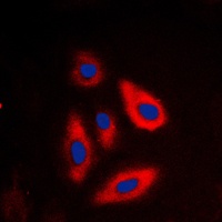 Galactose Kinase Rabbit Polyclonal Antibody