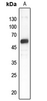 GDI1 Rabbit Polyclonal Antibody