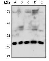 Connexin 32 Rabbit Polyclonal Antibody