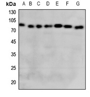 GCLC Rabbit Polyclonal Antibody