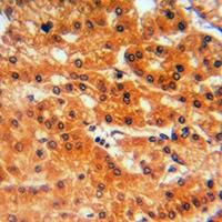 GCLC Rabbit Polyclonal Antibody