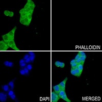 GCLC Rabbit Polyclonal Antibody
