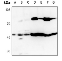 GOT1 Rabbit Polyclonal Antibody