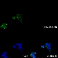 GOT1 Rabbit Polyclonal Antibody