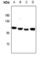GPIPLD Rabbit Polyclonal Antibody