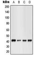 GPR17 Rabbit Polyclonal Antibody