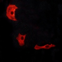 GPR17 Rabbit Polyclonal Antibody