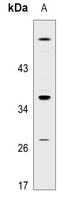 GPR18 Rabbit Polyclonal Antibody