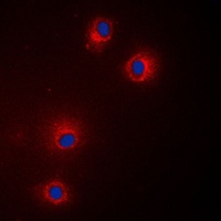 GPR18 Rabbit Polyclonal Antibody