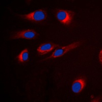 GPR18 Rabbit Polyclonal Antibody
