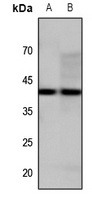 GPR34 Rabbit Polyclonal Antibody