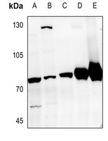 GRK6 Rabbit Polyclonal Antibody