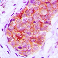 GRK6 Rabbit Polyclonal Antibody