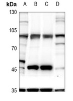 GLUR4 (Phospho-S862) Antibody