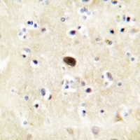GLUR4 (Phospho-S862) Antibody