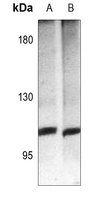 mGLUR4 Rabbit Polyclonal Antibody