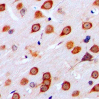 mGLUR4 Rabbit Polyclonal Antibody