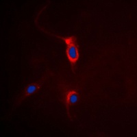 mGLUR4 Rabbit Polyclonal Antibody