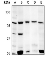 mGLUR6 Rabbit Polyclonal Antibody