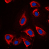 mGLUR6 Rabbit Polyclonal Antibody