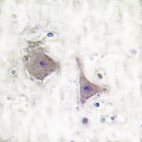 mGLUR7 Rabbit Polyclonal Antibody