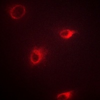 mGLUR7 Rabbit Polyclonal Antibody