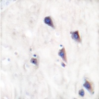 mGLUR8 Rabbit Polyclonal Antibody