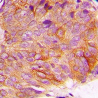 GSK3 alpha (Phospho-S21) Antibody