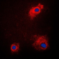 GSK3 alpha (Phospho-S21) Antibody