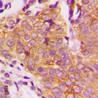 GSK3 beta (Phospho-S9) Antibody