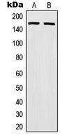 MSH6 Rabbit Polyclonal Antibody